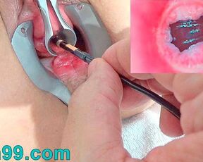 Endoscope Cam in Pee Hole with Semen and Sounding with Dildo